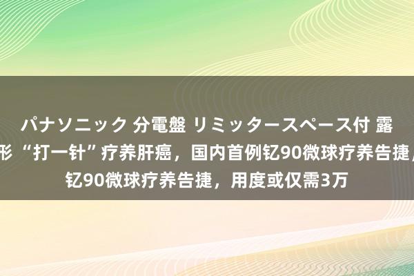 パナソニック 分電盤 リミッタースペース付 露出・半埋込両用形 “打一针”疗养肝癌，国内首例钇90微球疗养告捷，用度或仅需3万